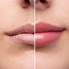 Ser Pentru Marirea Buzelor - Magic Lips